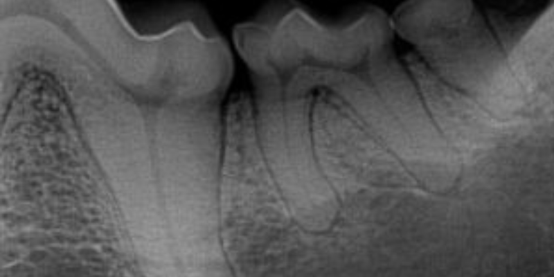 veterinary dentistry, the importance of veterinary dentistry, dentistry anesthesia, anesthesia for pets, veterinary anesthesia, Animal Emergency & Referral Center of Minnesota, Dentistry Service, Twin Cities veterinary dentist, board-certified veterinary dentist, Saint Paul veterinary dentist, Oakdale veterinary dentist