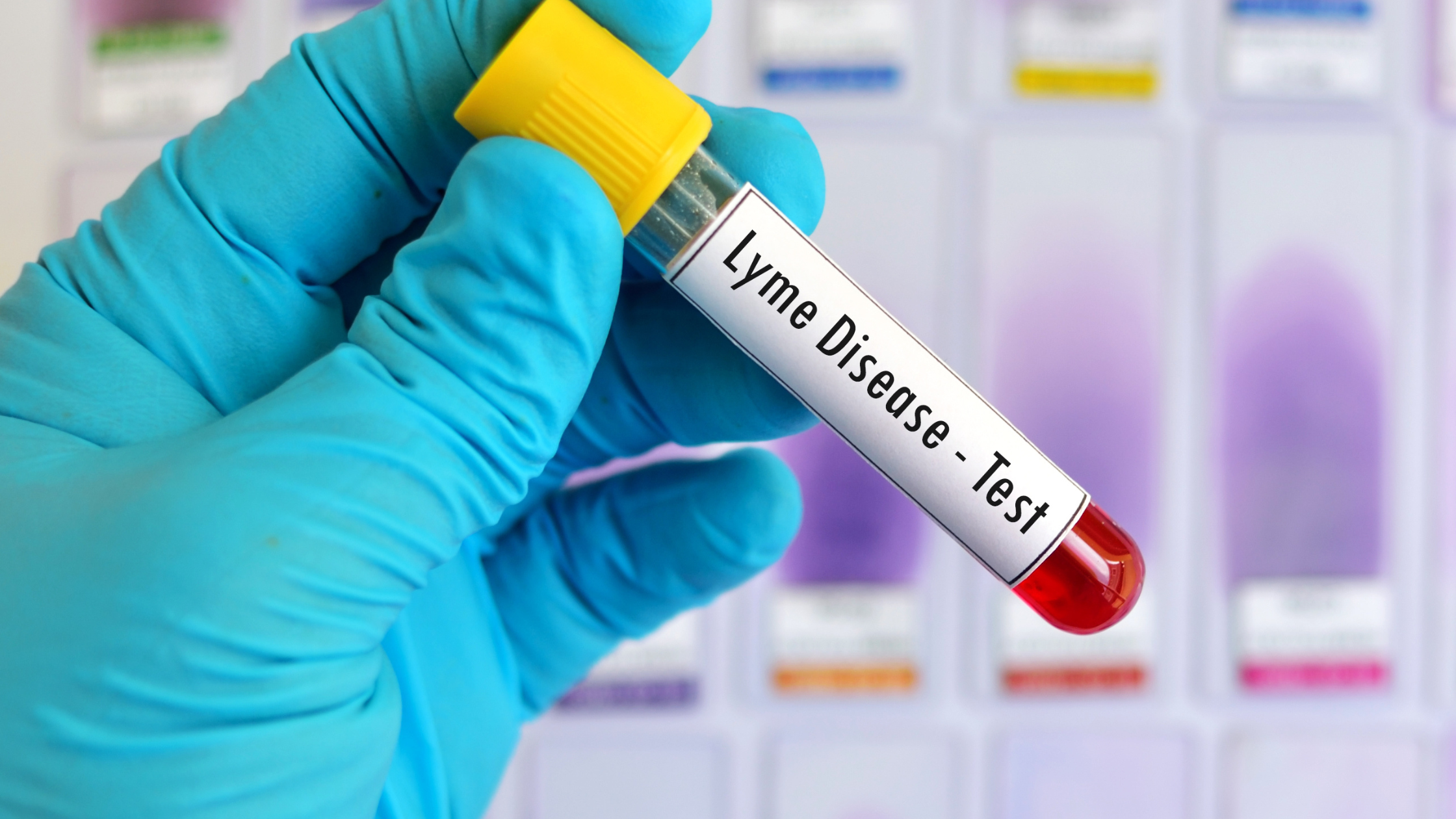 15 Facts about Lyme Disease
