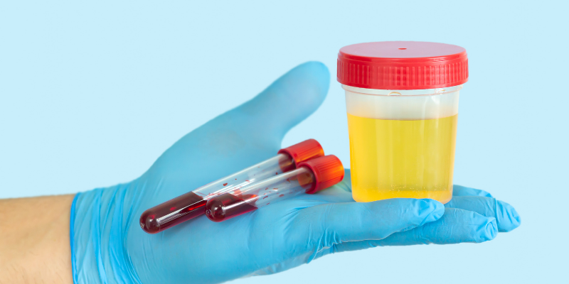 blood sample, urine sample, labwork, detect cancer early, detect pet cancer early, pet health, pets, cancer in pets, pet cancer, veterinary oncology, pet oncology, Animal Emergency & Referral Center of Minnesota, AERC Oncology