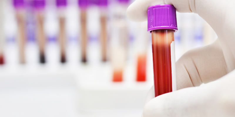 bloodwork, vile, lab, head tilts, head tilts in rabbits, head tilts in rodents, pet health, small companion animals, exotic pets, rabbits, rodents, Animal Emergency & Referral Center of Minnesota, Avian and Exotic Medicine Service, Twin Cities veterinary referral center