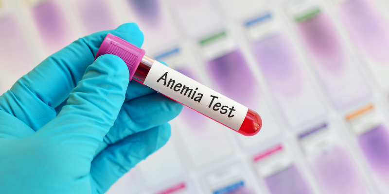 bloodwork, blood test, Allium poisoning in pets, Allium poisoning in cats, Allium poisoning in dogs, Allium toxicity, garlic, leeks, onions, chives, garlic poisoning in pets, onion poisoning in pets, leek poisoning in pets, chive poisoning in pets, pet emergency, anemia, anemia in pets, Twin Cities emergency vet, Minnesota emergency vet, Oakdale emergency vet, Saint Paul emergency vet, Animal Emergency & Referral Center of Minnesota