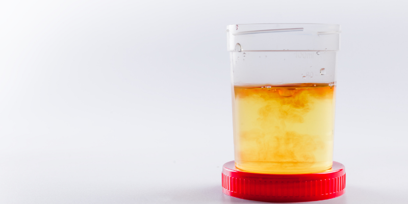 why is my dog peeing blood, bloody urine, blood in urine, dog has bloody urine, why does my dog have bloody urine, urinary inflammation, bladder stones, kidney disease, dogs, dog health, Animal Emergency & Referral Center of Minnesota