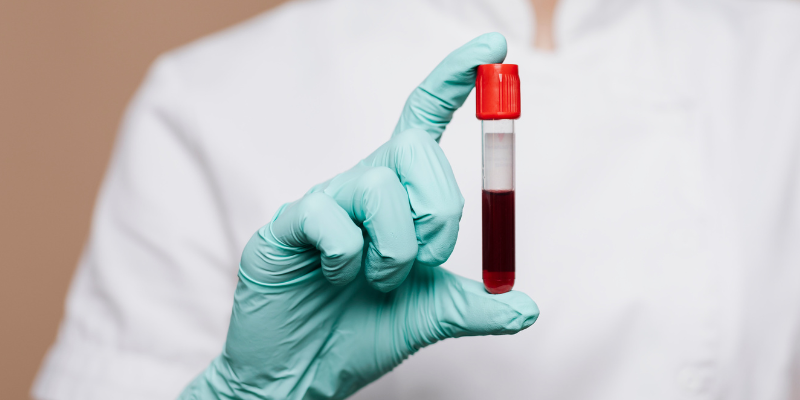 sepsis in pets, infections in pets, symptoms of sepsis in pets, diagnosing sepsis in pets, Animal Emergency & Referral Center of Minnesota, pet health, pet emergency, board-certified veterinary criticalist