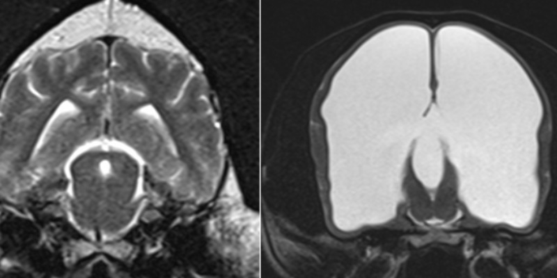 A brain MRI of a normal dog brain (left) and a hydrocephalic dog brain (right), Animal Emergency & Referral Center of Minnesota