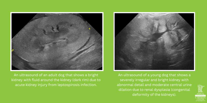 Two images of abdominal ultrasound findings. The left is An ultrasound of an adult dog that shows a bright kidney with fluid around the kidney (dark rim) due to acute kidney injury from leptospirosis infection. The right is An ultrasound of a young dog that shows a severely irregular and bright kidney with abnormal detail and moderate central urine dilation due to renal dysplasia (congenital deformity of the kidneys). Both ultrasounds from Animal Emergency & Referral Center of Minnesota.