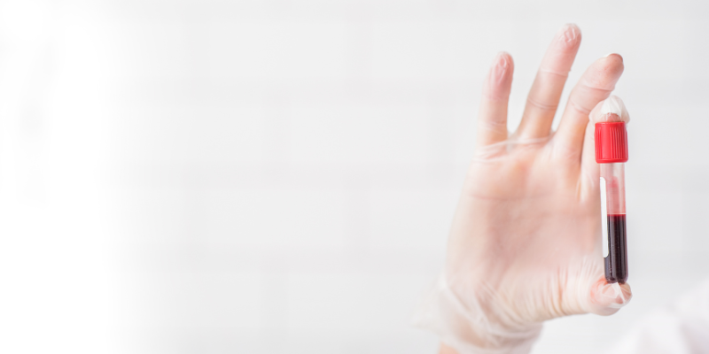 Gloved hands holding a blood work tube, benefits of toxicology hotlines, Animal Emergency & Referral Center of Minnesota