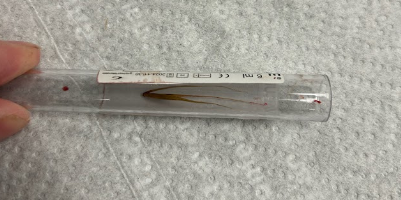 A sample tube containing an intact grass awn – a 2.5 cm piece of Foxtail to be exact - that was found within Beck the Irish Setter’s chest cavity. 