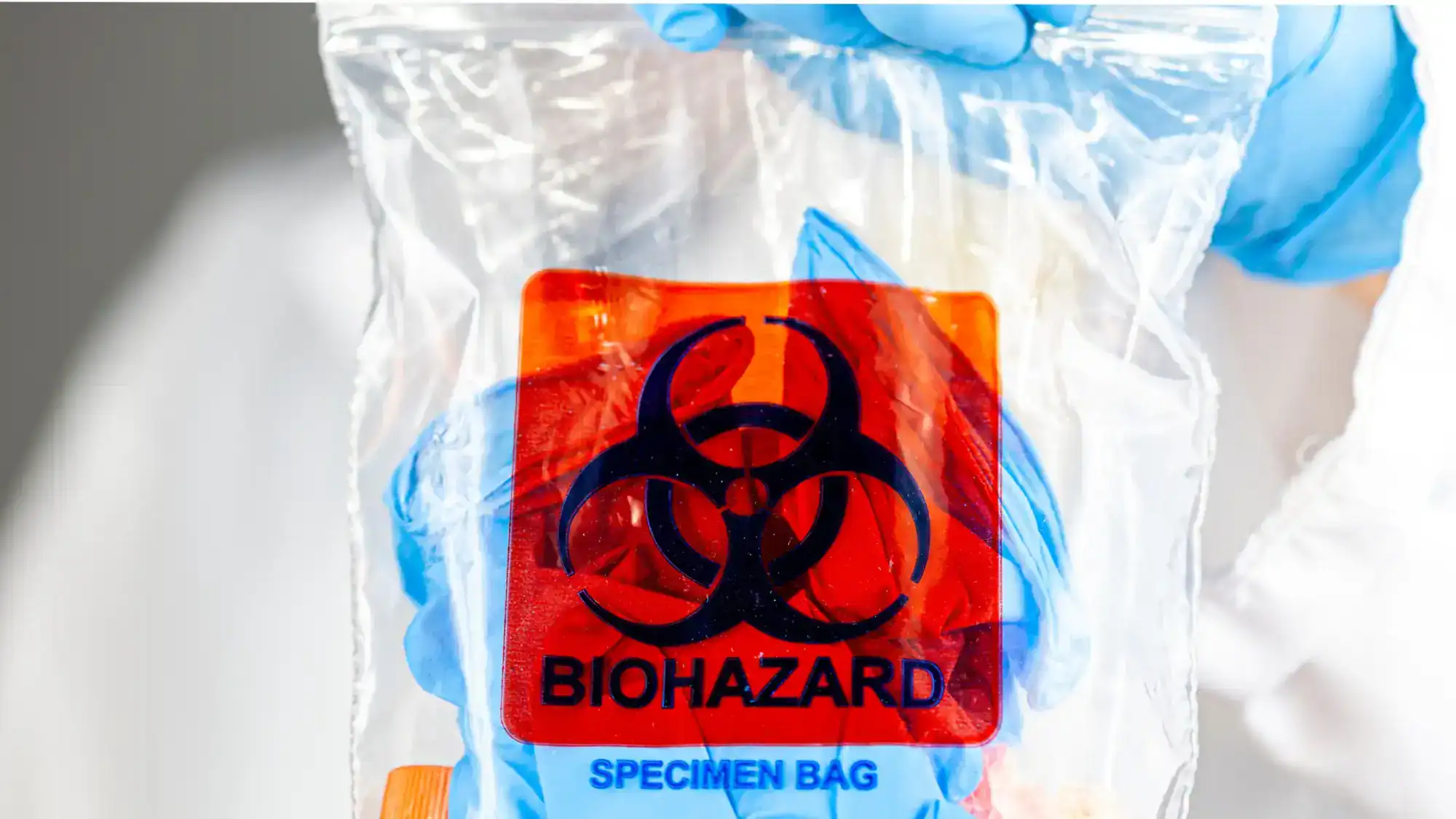 Gloved hands holding up a plastic bag with a biohazard label.